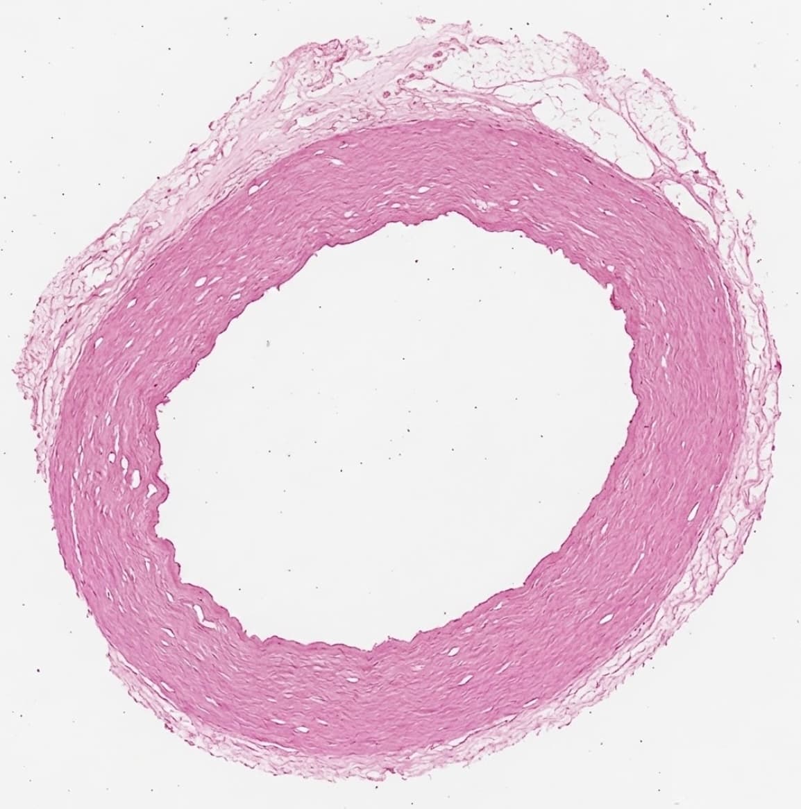 Tissue fiber matrix under microscopy — pure decellularized extracellular matrix scaffold